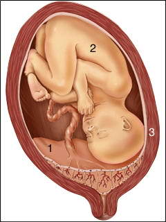 simptome placenta previa